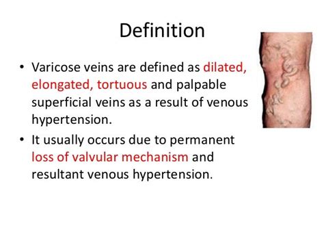 similar vein|similar veins definition.